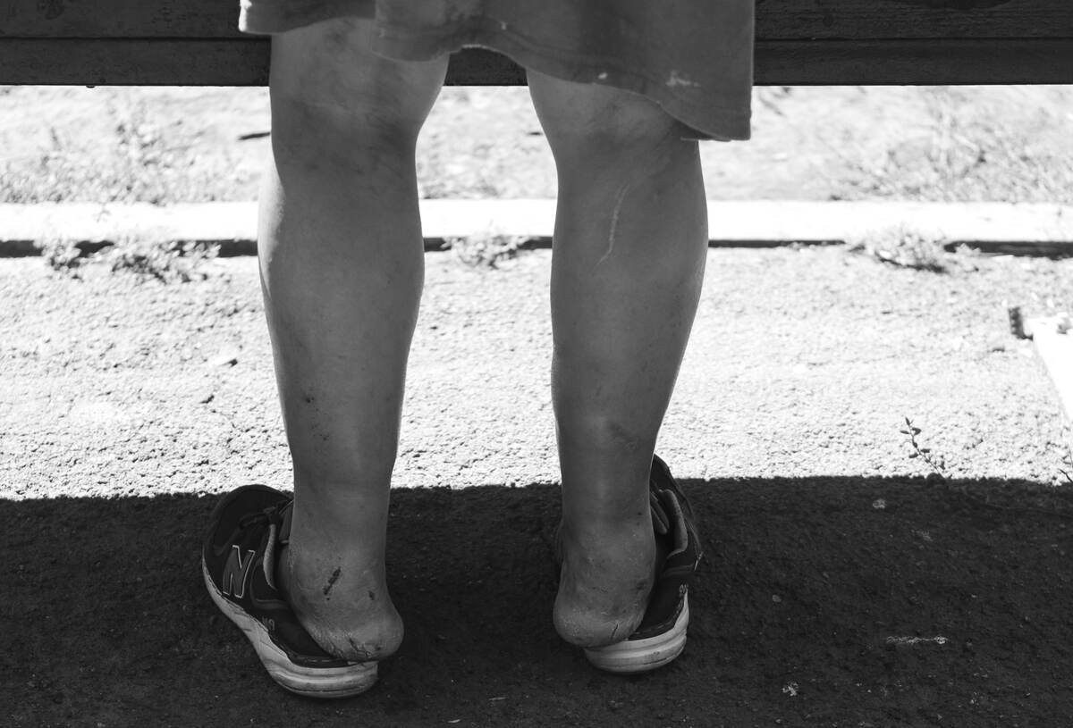 Homelessness in Bishkek